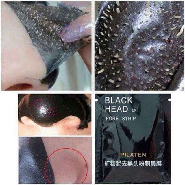 Black head pore