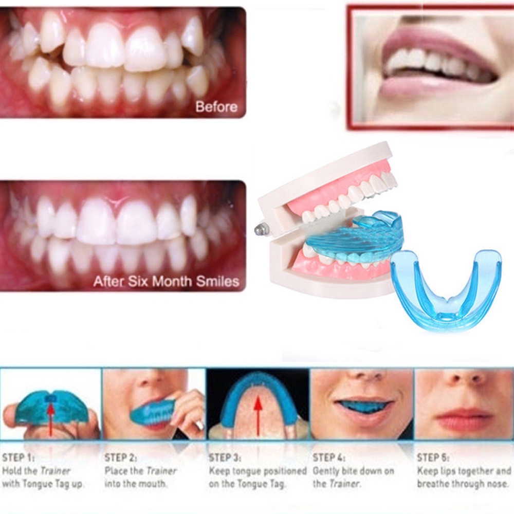 silicone teeth alignment