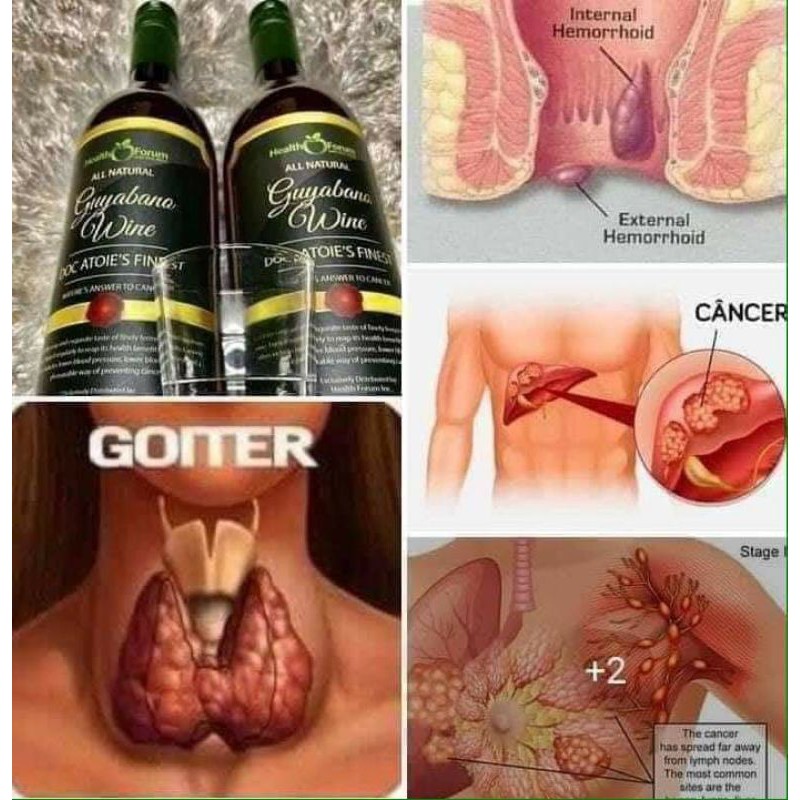 Guyabano Wine Nature S Answer To Cancer By Doc Atoie Shopee Philippines