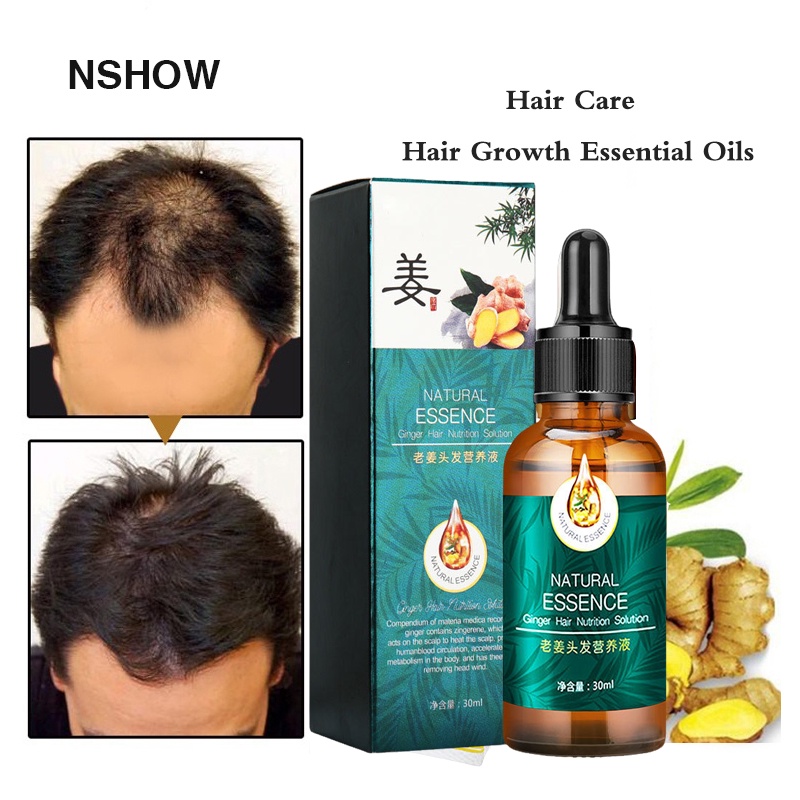 Hair Growth Serum Ginger Hair Treatment Ginger Essential Anti Hair Loss