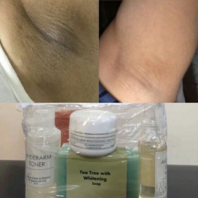 SKIN LOUNGE's BEST SELLER UNDERARM WHITENING SET Shopee Philippines