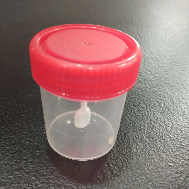Urine and stool specimen container with spoon (1 piece only) Shopee