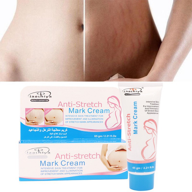 nourishing stretch mark cream