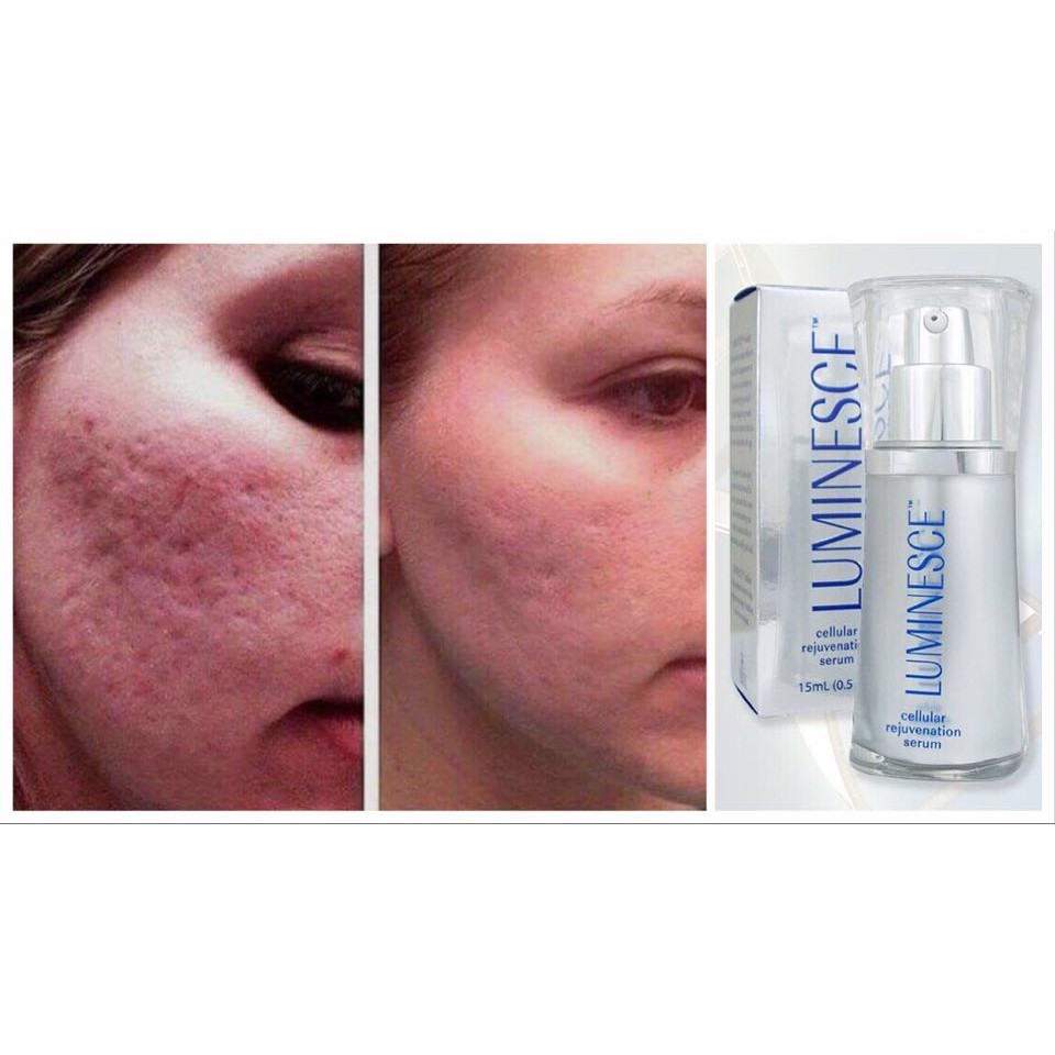 luminesce serum