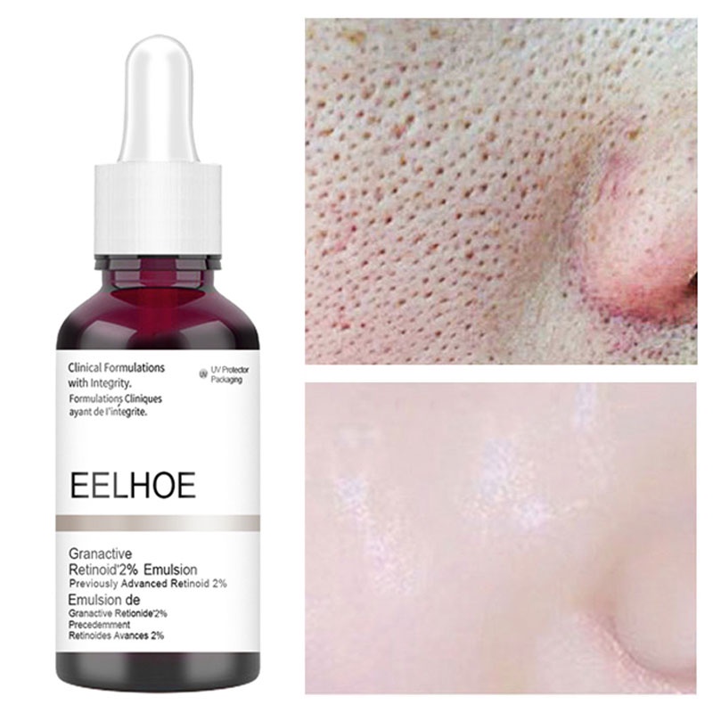 Salicylic Acid Pore Shrinking Serum Fruit Acid Exfoliating Fade Acne