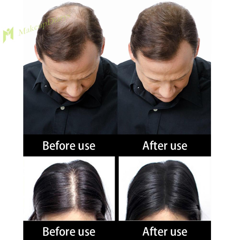 1pc Pro Hair Building Fibers Hair Loss Treatment Care Conceal