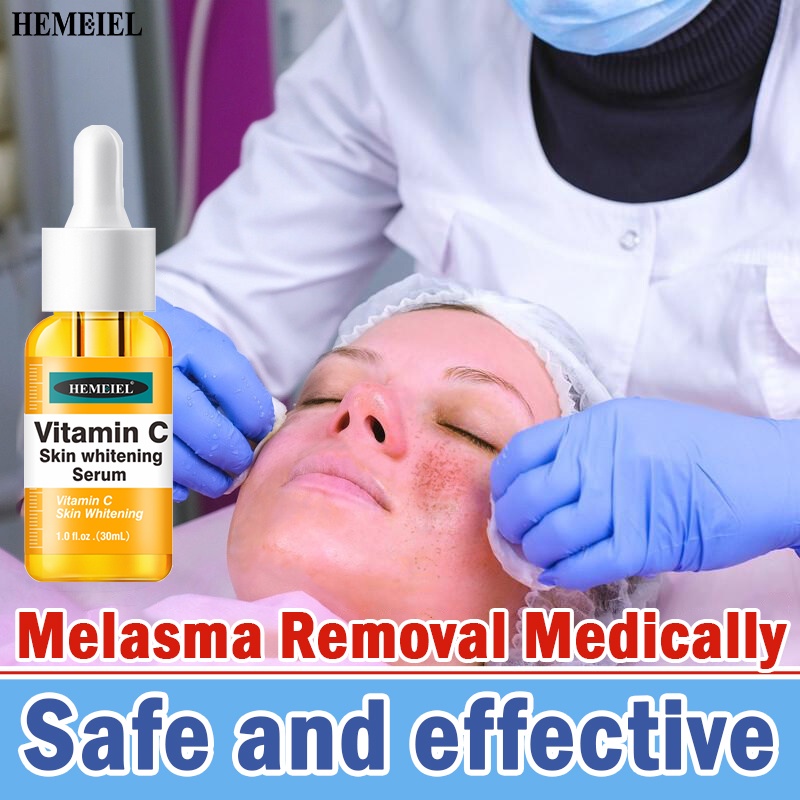 HEMEIEL vitamin c serum whitening melasma pekas dark spot