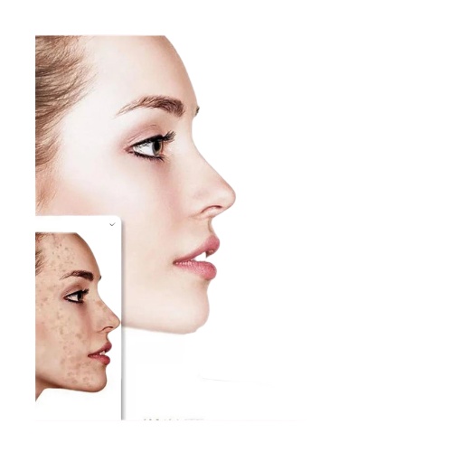 AD VOVA Vitamin C 20 Face Cream Whitening Remove Dark Spots Facial Gel