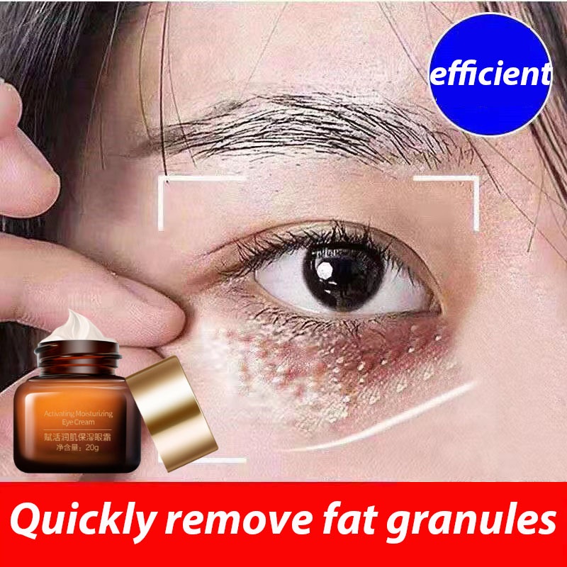Eye cream to lighten dark circles, remove and repair fat particles, eye