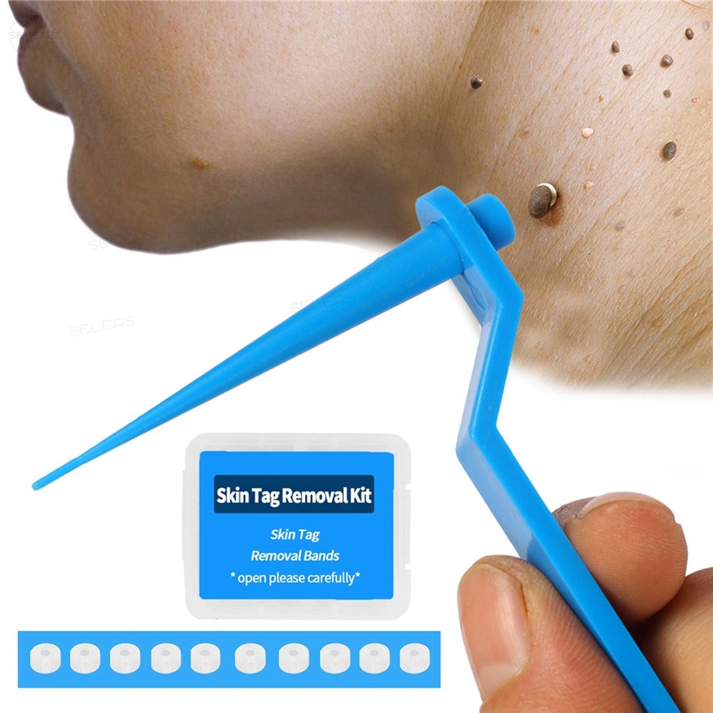 Skin Tag Remover Band Warts Removal Rubber Band Adult Mole Kulugo