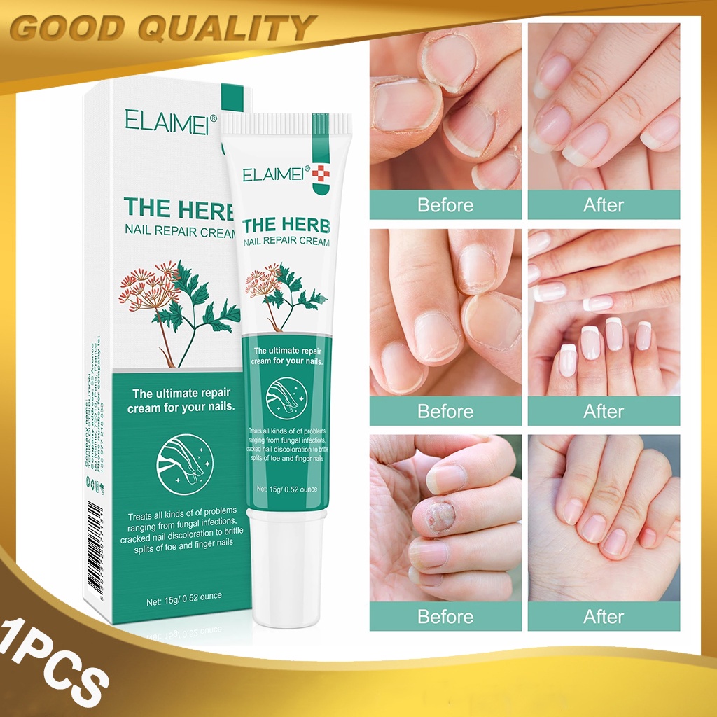 Fungal Nail Repair Cream 15g Anti Fungus Nails Treatment AntiFungal