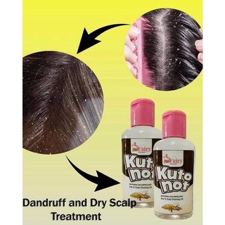 Kuto Not Natural Scalp Cleansing Oil & Lice Treatment Hair Scalp Clean & Natural Lice Treatment Hair #5