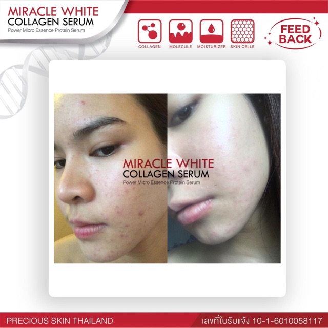 miracle white collagen serum
