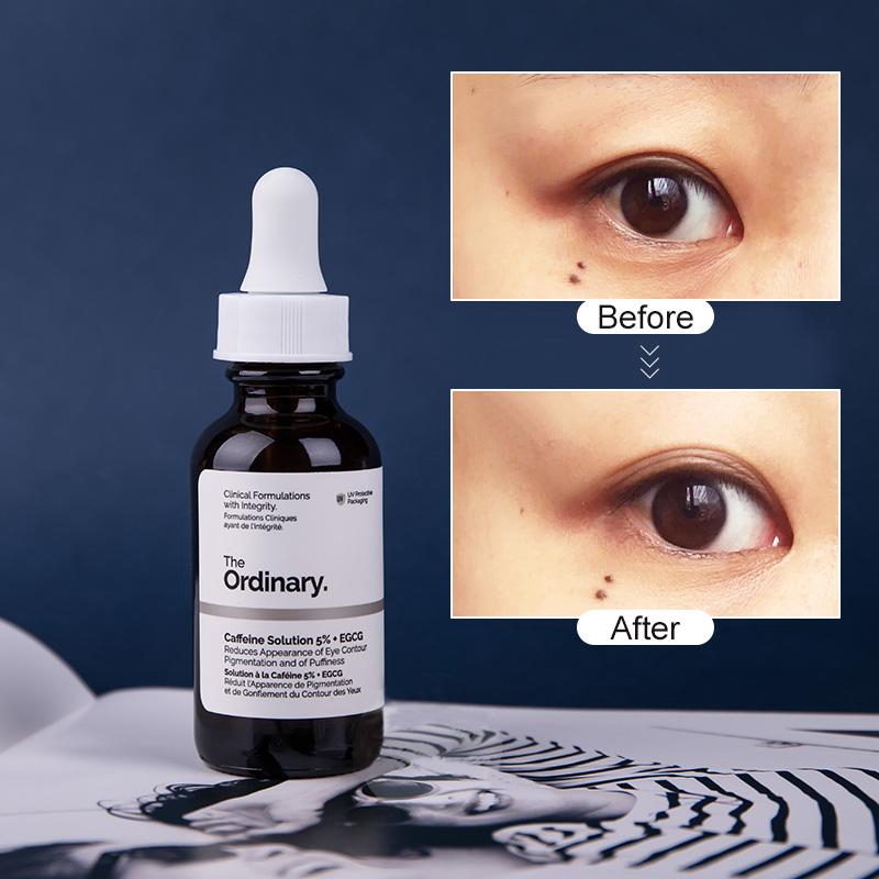 ordinary eye cream