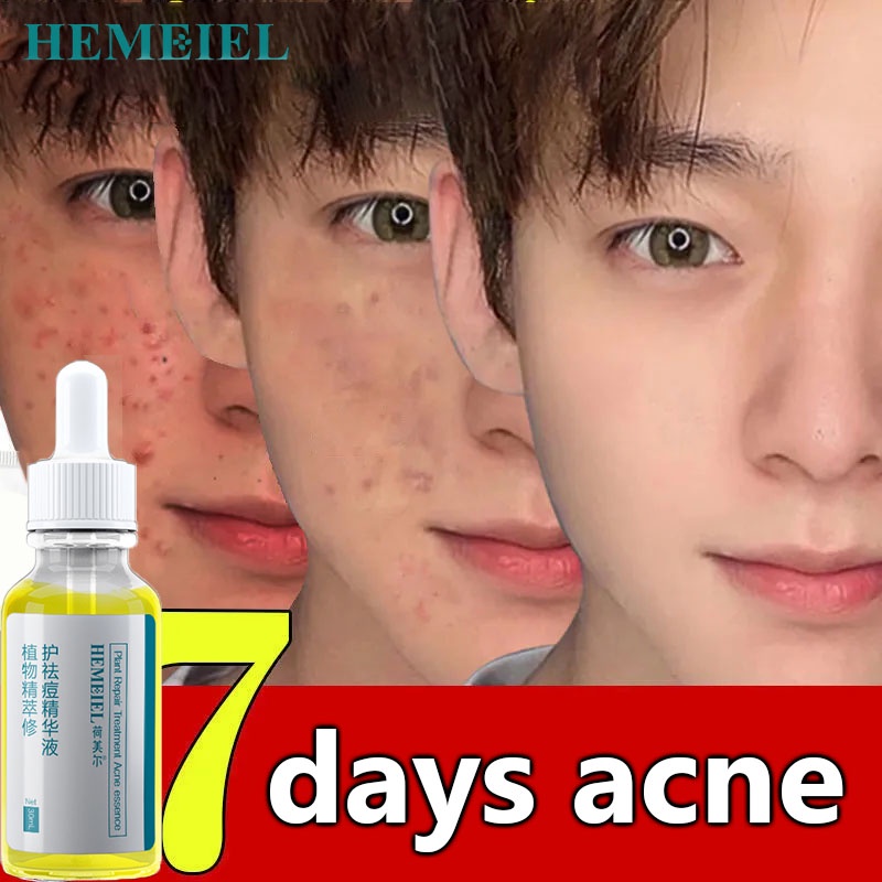 HEMEIEL Dr Seoul Dark Spot Eraser Set Original/Master Anti Pimple/Acne