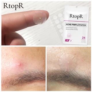 RtopR Acne Pimple Patch Invisible Acne Treatment Stickers Treatment Pimple Remover Tool Skin Care Waterproof 24 Patches Daily And Night Use #3