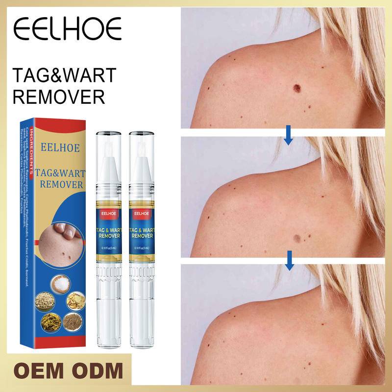 Eelhoe Mole Removal Pen Anti Verruca Remedy Mole Wart Remover Spot Body Skin Tag Remover Liquid