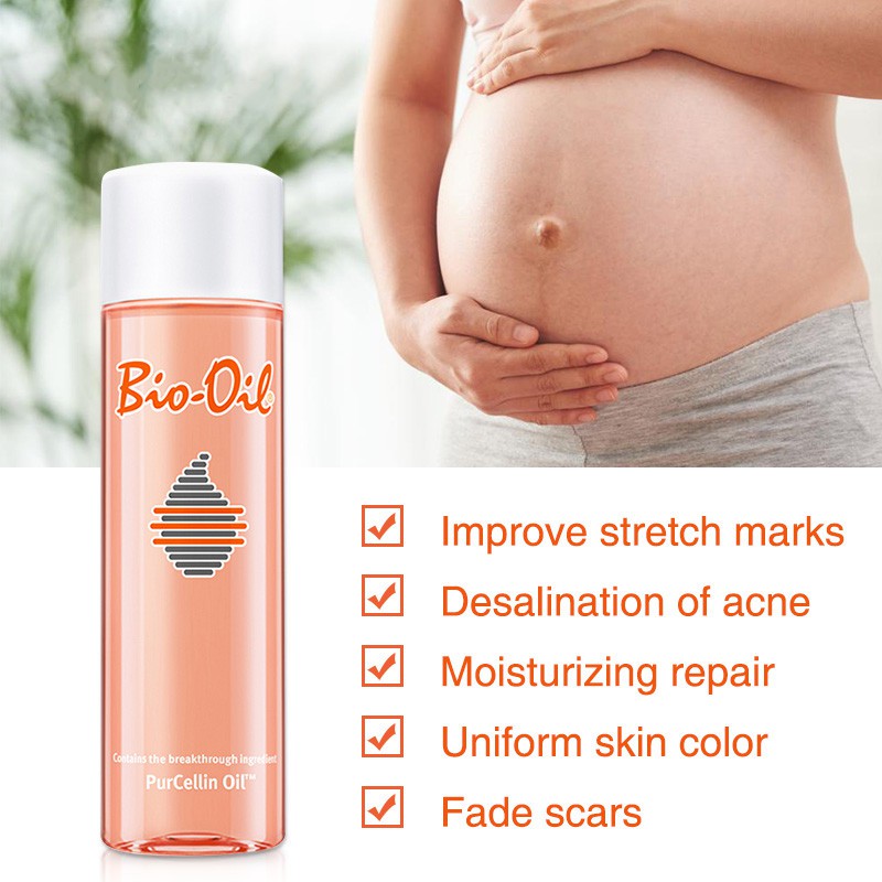 Recommended By Dermatologist Enhanced Edition 100 Australian Bio Oil 200ml Skin Care Acne Stretch Marks Removal Cream Shopee Philippines