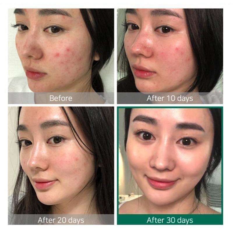 Aha Bha Peeling Solution With Niacinamide