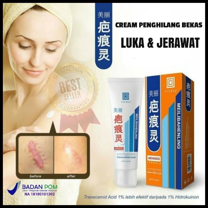 Genuine Quality Mosquito Bite Removal Cream Scratch Scar Removal Cream