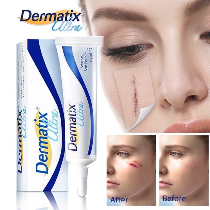 Australia Dermatix Scar Gel Acne Scars Treatment Scar Removal Cream