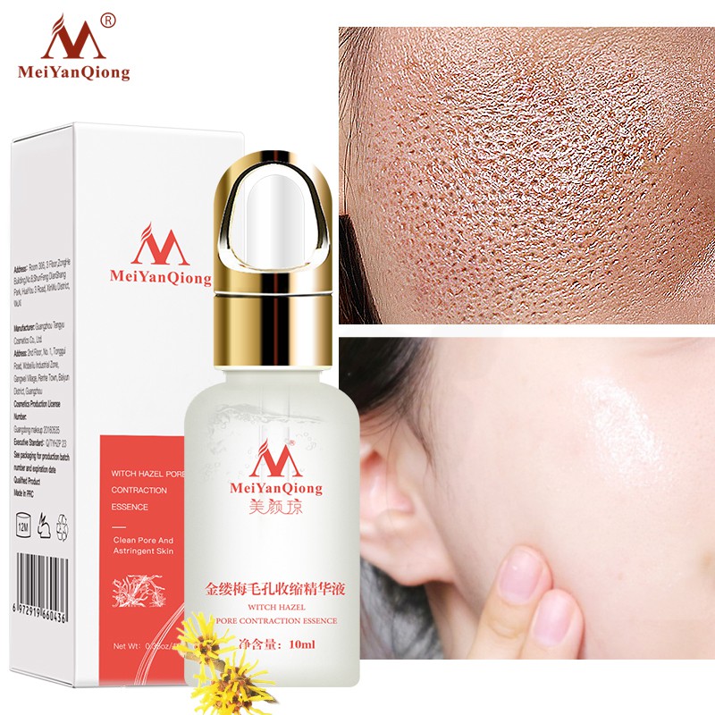 does witch hazel reduce pores