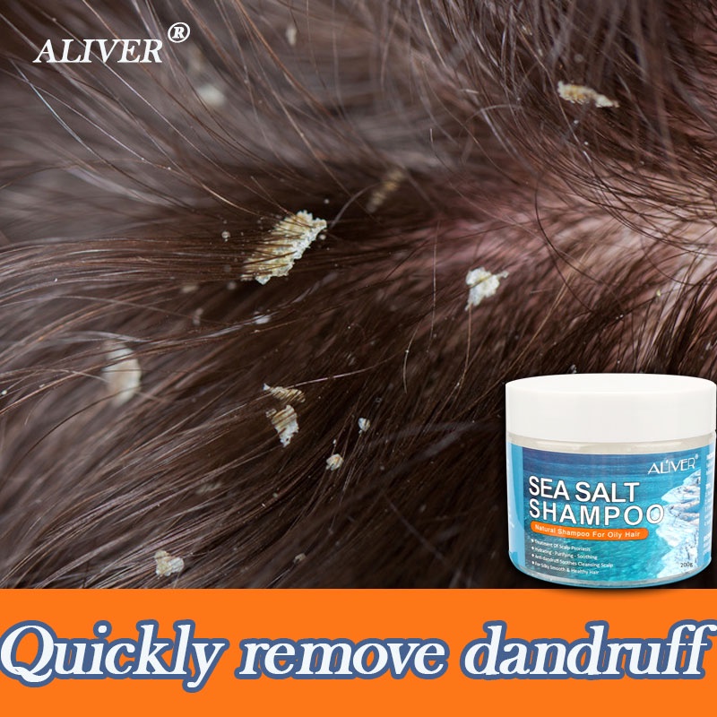 Quickly remove dandruff. ALIVER sea salt shampoo dandruff lice remover