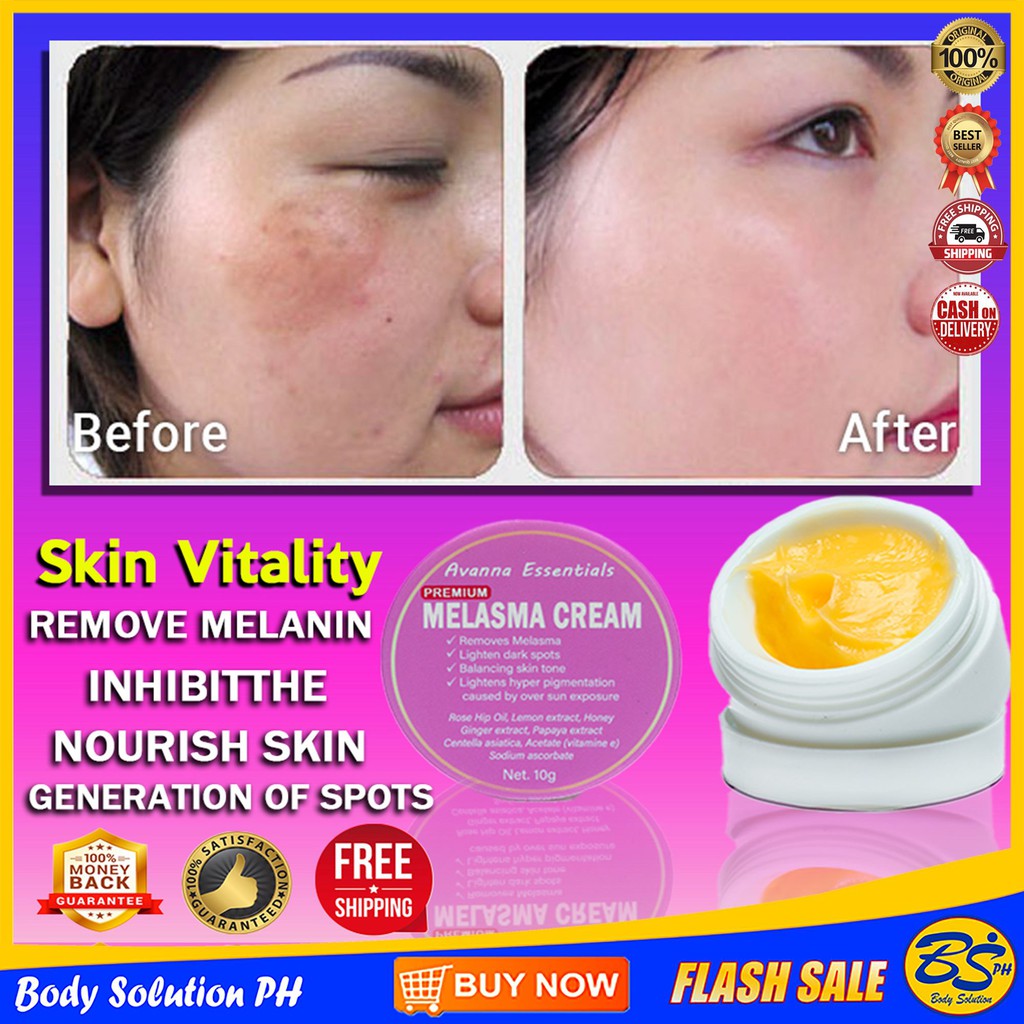New Original Melasma Pekas Sun and Dark Spots Remover Cream 10g (1 Jar
