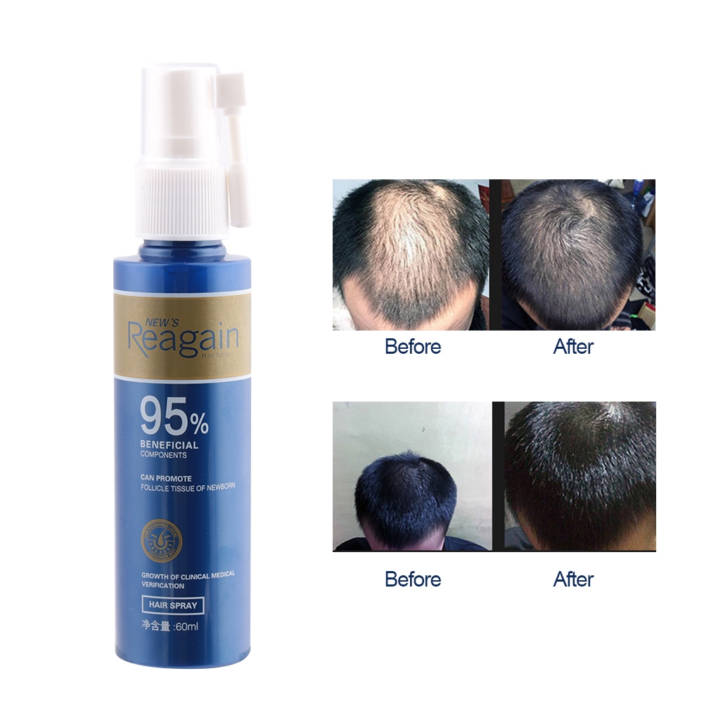 60ml Hair Growth Natural Treatment Herbal Essence Hair Fast