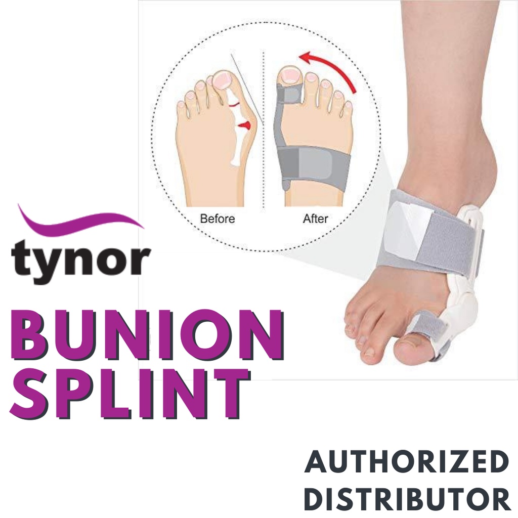 TYNOR Bunion Splint for Correcting Big Toe Deformities Model K14