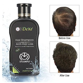 Merry Sun Ginger Scalp Treatment Anti Hair Loss Shampoo Shopee