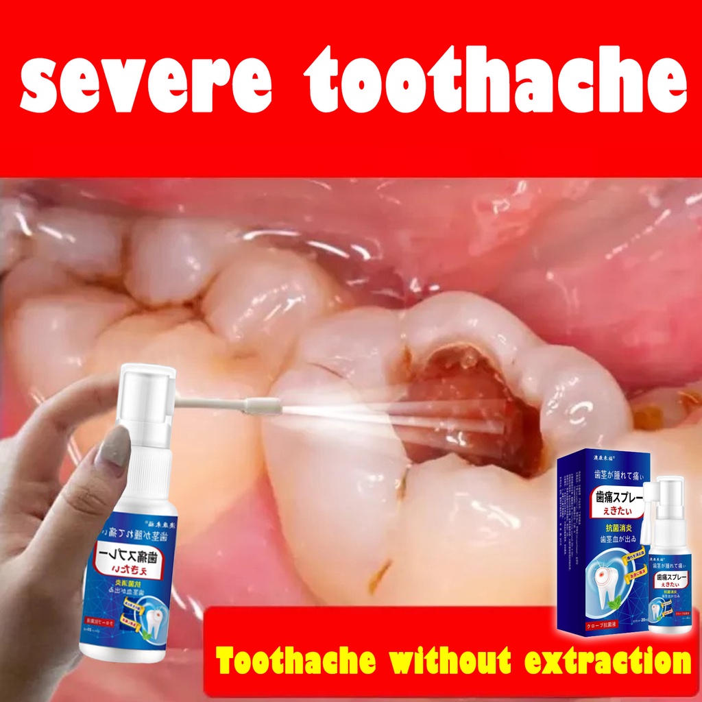 toothache repellent Toothache Insect Repellent Spray toothache oral