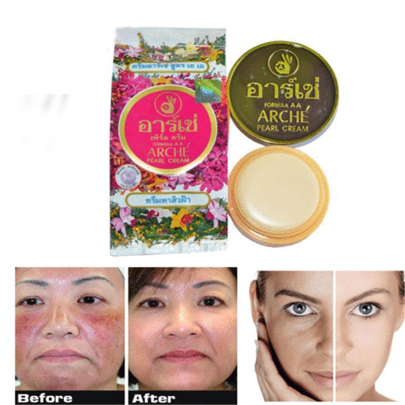 arche cream for acne