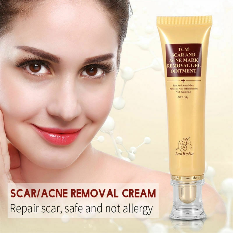 face cream to remove acne scars