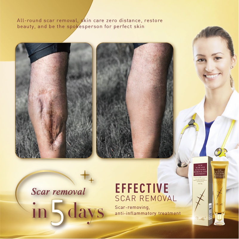 Scar Remover Gel Cream Scar peklat old acne scar Remover Skin Care Acne
