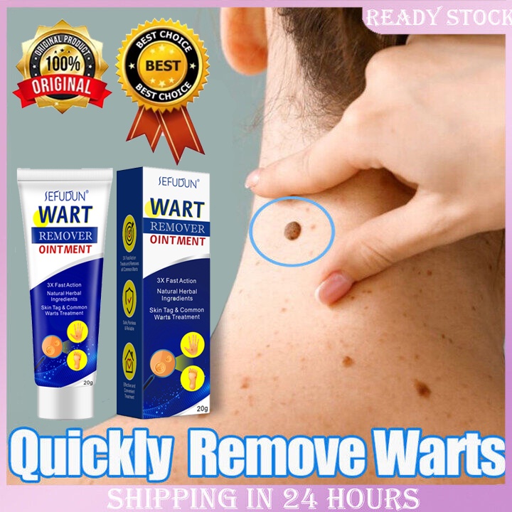 sefudun-original-painless-warts-remover-ointment-cream-effectively