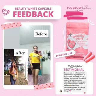 You Glow Babe Glutathione Collagen Slimming Capsules Shopee Philippines