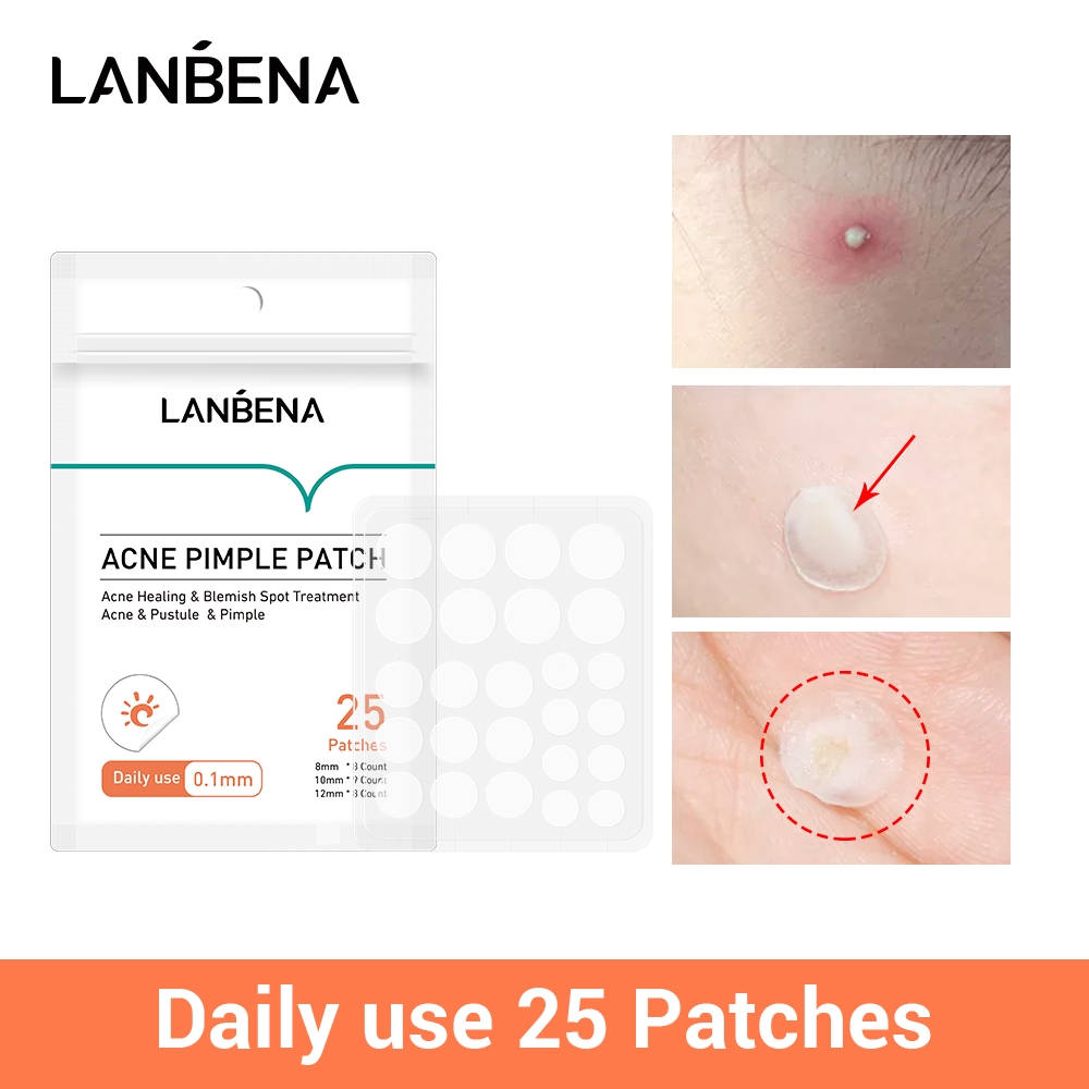 Lanbena Acne Pimple Patch Daily Use Face Mask Invisible Acne Stickers Blemish Treatment Acne Master Beauty Tool Skin Care 25pcs Shopee Philippines