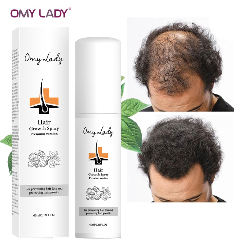 OMY LADY Anti Hair Loss Help Hair Growth Spray Essential Oil 60ml