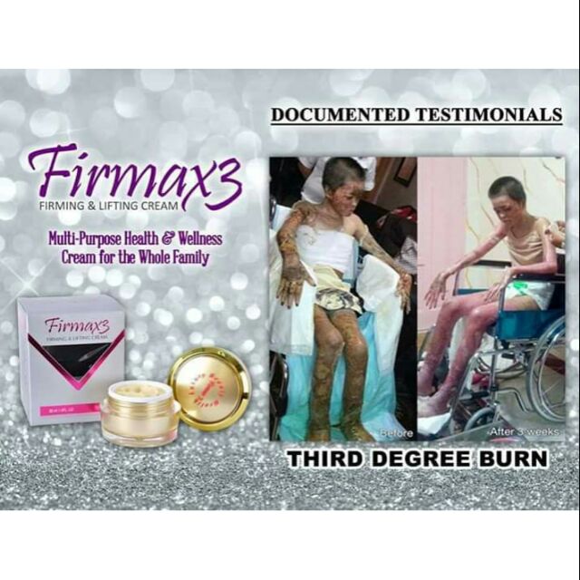firmax3 miracle cream