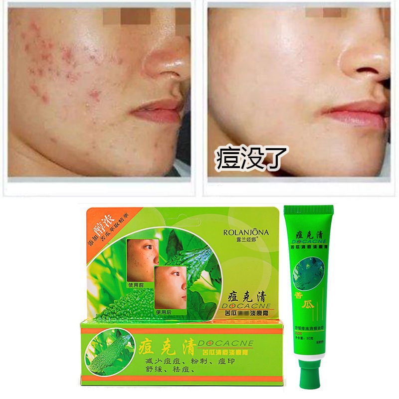 Acne Cream Pimples Skincare Lulan Jina Clearing Bitter Gourd Control ...