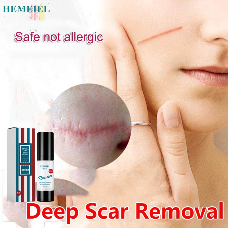HEMEIEL Magic Scar Remover Gel Original/Leave no trace/Deep Scar Removal