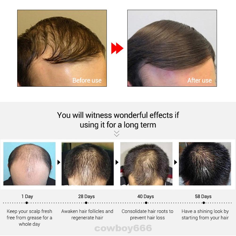 Essential Oil Liquid Treatment Powerful Strengthen Hair Prevent Alopecia