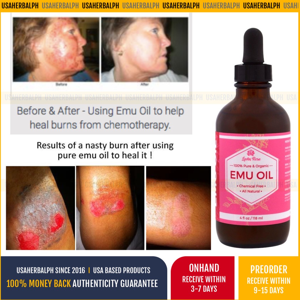 Emu Oil,100 Pure & Organic Hair Grower,psoriasis,acne scars, burns