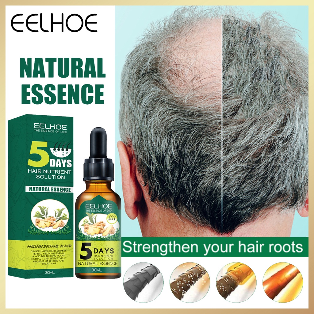 Eelhoe 30ml 5 Days Growth Ginger Hair Essence Nutrition Liquid Oil