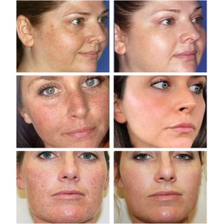 Vitamin C Collagen Cream Whitening Face Cream melasma cream Dark Spots Melanin Remover 50g #4