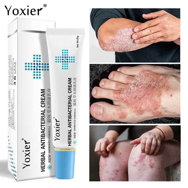Antibacterial Cream Psoriasis Cream Eczema Cream Relief Skin Rash