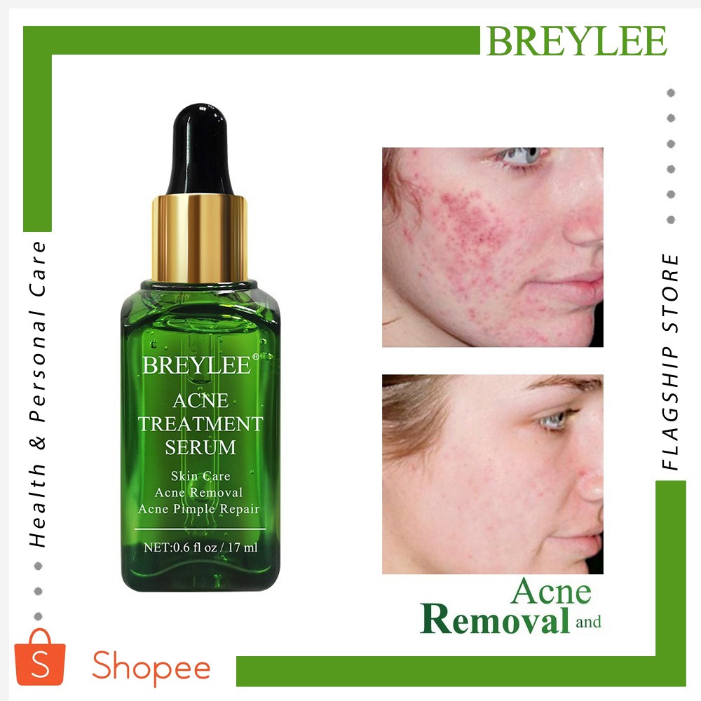 BREYLEE Acne Treatment Serum Hemorrhoid Essence Anti Acne Scar Removal