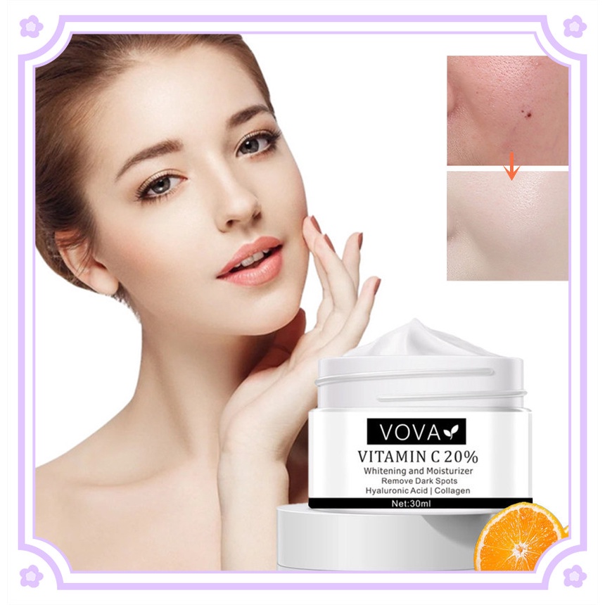 Vova 30ml Vitamin C Whitening Freckle Cream Fade Freckls Remove Dark