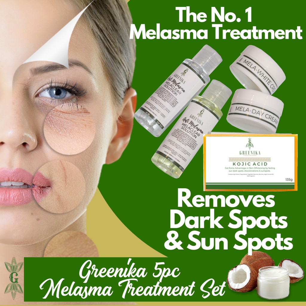 melasma facial